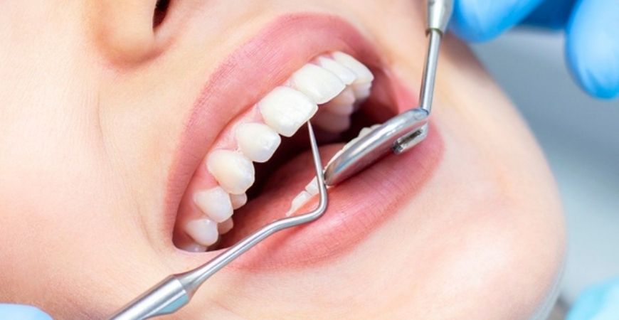 teeth examination